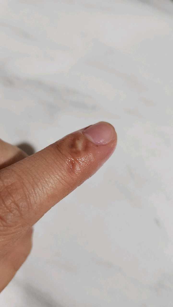 크루톡 이미지