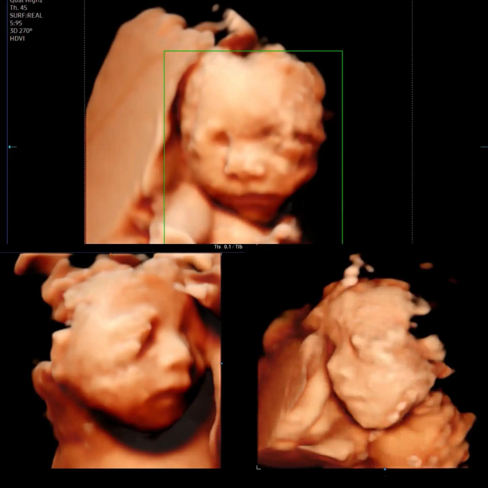 크루톡 이미지 1