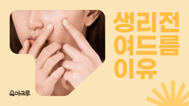 생리 전에 여드름이 심해지는 이유 (턱드름)