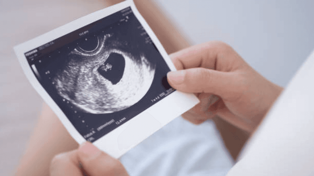 태아 성별, 언제 알 수 있을까? 초음파 각도법과 속설